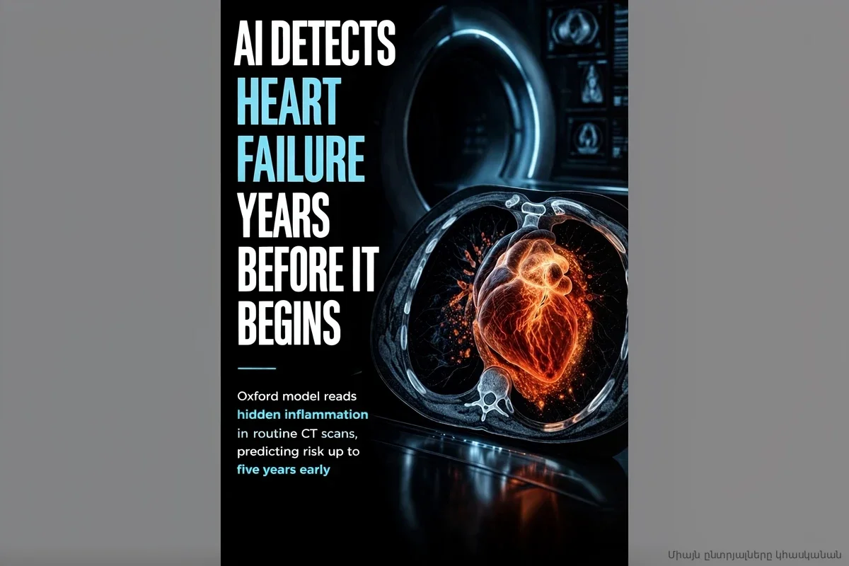 Нейросеть из Оксфорда нашла способ предсказать отказ сердца с точностью 86%